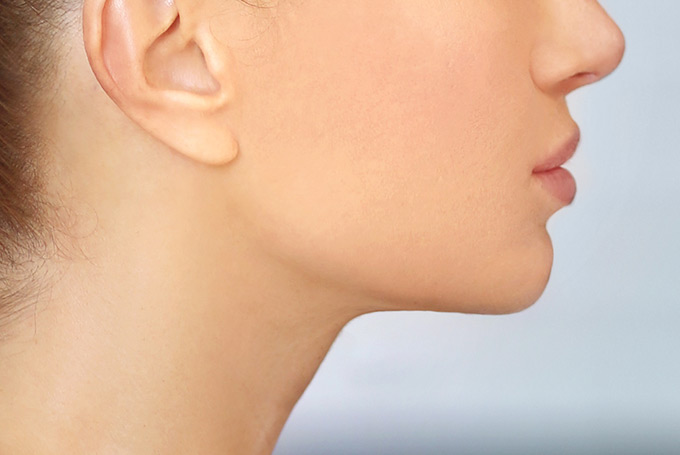 Learn about Chin Surgery