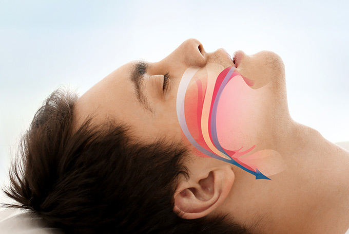 Learn About Sleep Apnea