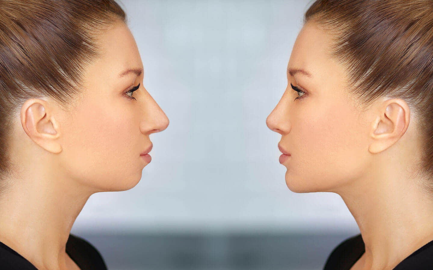 Chin Surgery (Genioplasty) in Los Angeles, CA | Jaw Surgery LA