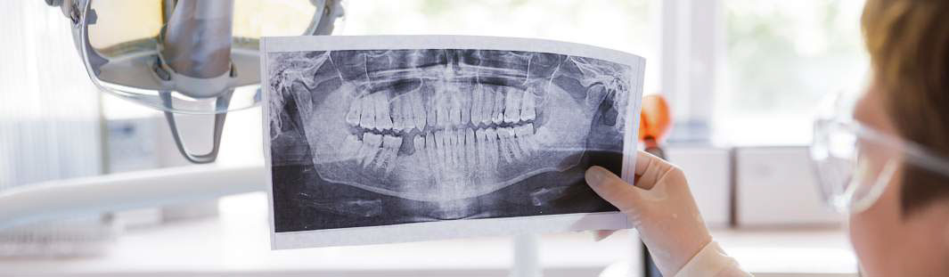Jaw X-Ray