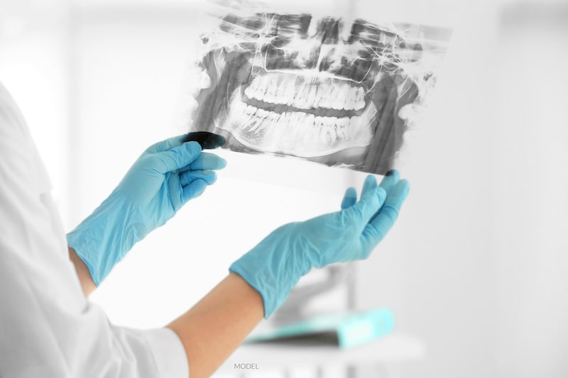 Female doctor holding x-ray of mouth and jaw.